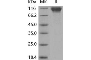 Western Blotting (WB) image for Selectin L (SELL) (Active) protein (His tag,Fc Tag) (ABIN7197875) (L-Selectin Protein (His tag,Fc Tag))