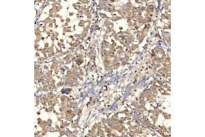 IHC analysis of Mitochondrial Dicarboxylate Carrier/SLC25A10 using anti-Mitochondrial Dicarboxylate Carrier/SLC25A10 antibody (ABIN7601497).
