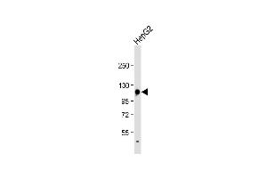 Anti-GLDC Antibody (N-term) at 1:1000 dilution + HepG2 whole cell lysate Lysates/proteins at 20 μg per lane.