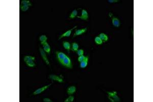 Immunofluorescent analysis of Hela cells using ABIN7160870 at dilution of 1:100 and Alexa Fluor 488-congugated AffiniPure Goat Anti-Rabbit IgG(H+L) (SIRT5 antibody  (AA 60-212))