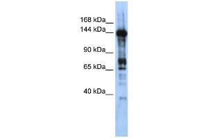WB Suggested Anti-CASZ1 Antibody Titration:  0.