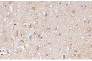 Immunohistochemistry of paraffin-embedded Rat brain using NAA20 Polyclonal Antibody at dilution of 1:100 (40x lens).