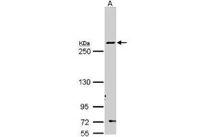 WB Image Sample (30 ug of whole cell lysate) A: Molt-4 , 5% SDS PAGE antibody diluted at 1:1000 (Fatty Acid Synthase antibody  (N-Term))