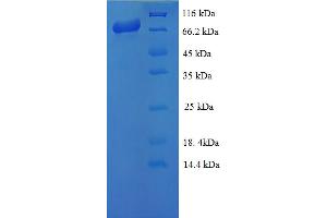 SDS-PAGE (SDS) image for Doublecortin-Like Kinase 1 (DCLK1) (AA 1-754), (full length) protein (His-SUMO Tag) (ABIN5711159)