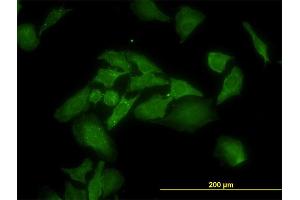 Immunofluorescence of monoclonal antibody to ANKRA2 on HeLa cell. (ANKRA2 antibody  (AA 1-98))