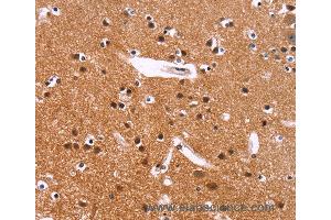 Immunohistochemistry of Human brain  using IRAK1BP1 Polyclonal Antibody at dilution of 1:40 (IRAK1BP1 antibody)