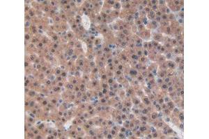 IHC-P analysis of liver tissue, with DAB staining. (beta-Thromboglobulin antibody  (AA 46-107))