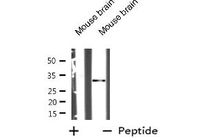 Western blot analysis of MARCKS expression in Mouse brain tissue lysates,The lane on the left is treated with the antigen-specific peptide.