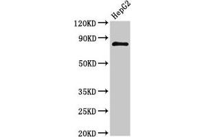 Western Blot Positive WB detected in: HepG2 whole cell lysate All lanes: NR3C1 antibody at 3 μg/mL Secondary Goat polyclonal to rabbit IgG at 1/50000 dilution Predicted band size: 86, 82, 65, 61, 83, 79, 77, 76, 52, 51, 50 kDa Observed band size: 86 kDa (Glucocorticoid Receptor antibody  (AA 1-190))