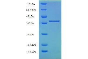 Lysozyme-Like 1 Protein (LYZL1) (AA 1-194) (His-SUMO Tag)