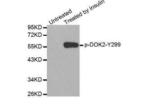 Western blot analysis of extracts from Jurkat cells using Phospho-DOK2-Y299 antibody (ABIN2987731). (DOK2 antibody  (pTyr299))
