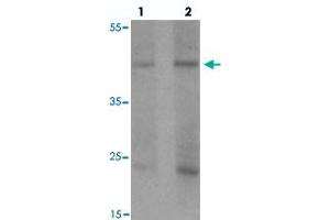 Western blot analysis of PELI1 in human liver tissue with PELI1 polyclonal antibody  at (1) 1 and (2) 2 ug/mL. (Pellino 1 antibody  (C-Term))
