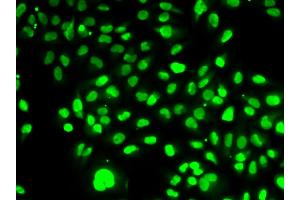 Immunofluorescence analysis of HeLa cells using NAMPT antibody. (NAMPT antibody)