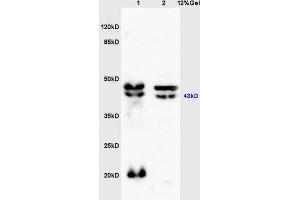 SDS-PAGE (SDS) image for anti-Bradykinin Receptor B2 (BDKRB2) (AA 51-150) antibody (ABIN740040)