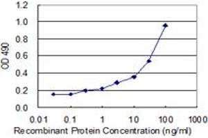 Sandwich ELISA detection sensitivity ranging from 0. (AKR1D1 (Human) Matched Antibody Pair)