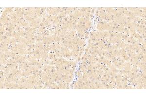 Detection of CD40L in Human Liver Tissue using Polyclonal Antibody to Cluster Of Differentiation 40 Ligand (CD40L) (CD40 Ligand antibody  (AA 1-261))