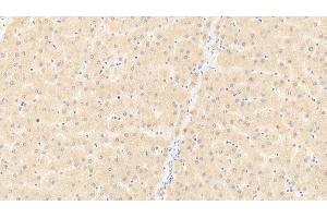 Detection of CD40L in Human Liver Tissue using Polyclonal Antibody to Cluster Of Differentiation 40 Ligand (CD40L) (CD40 Ligand antibody  (AA 1-261))