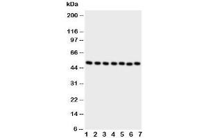 Western blot testing of CTBP2 antibody and Lane 1:  rat brain;  2: rat spleen ;  3: HeLa;  4: 293T;  5: COLO320;  6: U87;  7: SW620 cell lysate
