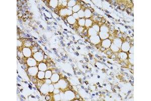 Immunohistochemistry of paraffin-embedded Human colon using CCDC92 Polyclonal Antibody at dilution of 1:100 (40x lens).