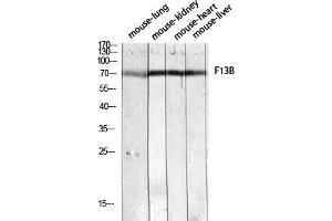 Western Blot (WB) analysis of Mouse Lung Mouse Kidney Mouse Heart Mouse Liver lysis using F13B antibody. (F13B antibody)