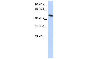 PDIA6 antibody used at 1 ug/ml to detect target protein.