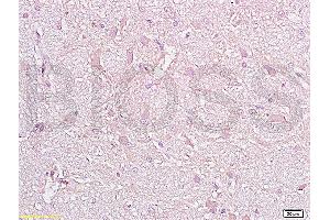 Formalin-fixed and paraffin embedded rat brain tissue with labeled Anti-CD38 Polyclonal Antibody, Unconjugated (ABIN730498) at 1:200, followed by conjugation to the secondary antibody and DAB staining