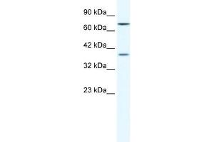 Western Blot showing ZNF660 antibody used at a concentration of 1-2 ug/ml to detect its target protein. (ZNF660 antibody  (C-Term))