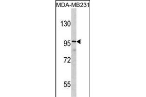 DLGAP1 antibody  (N-Term)