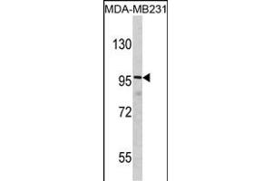 Western blot analysis of DLG Antibody (N-term) (ABIN390832 and ABIN2841058) in MDA-M cell line lysates (35 μg/lane).