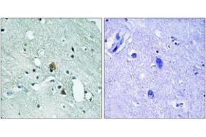 Immunohistochemistry analysis of paraffin-embedded human brain, using IP3R1 (Phospho-Ser1764) Antibody. (ITPR1 antibody  (pSer1764))