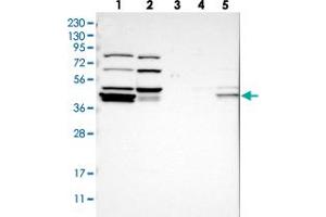 Western blot analysis of Lane 1: RT-4, Lane 2: U-251 MG, Lane 3: Human Plasma, Lane 4: Liver, Lane 5: Tonsil with RDBP polyclonal antibody  at 1:250-1:500 dilution.