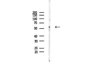 anti-Nucleosome Assembly Protein 1-Like 4 (NAP1L4) (Internal Region) antibody