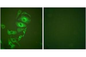 Immunofluorescence analysis of HepG2 cells, using Keratin 17 Antibody. (KRT17 antibody  (AA 381-430))