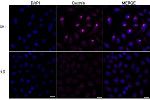 Immunocytochemical staining of HeLa cells using Desmin antibody (ABIN7798314), 1:1,000), Top panel: wild-type (WT), Bottom panal: Desmin shRNA knockdown (KD). (Recombinant Desmin antibody)