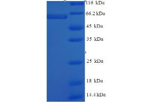 LMAN1L Protein (AA 26-462) (His-SUMO Tag)