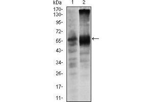 Western blot analysis using SOX9 mouse mAb against Lovo (1) and SW620 (2) cell lysate. (SOX9 antibody)