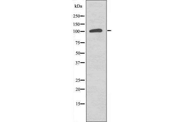 NEMF 抗体  (C-Term)