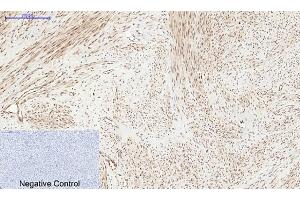 Immunohistochemical analysis of paraffin-embedded human uterus tissue. (PERK antibody  (pThr981))