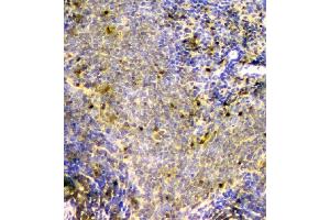 IHC analysis of SCN4B using anti-SCN4B antibody (ABIN6719653).