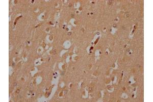IHC image of ABIN7174973 diluted at 1:200 and staining in paraffin-embedded human brain tissue performed on a Leica BondTM system. (Myosin XV (MYO15) (AA 237-451) antibody)