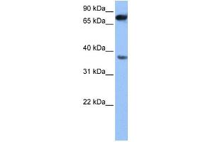 WB Suggested Anti-ZCCHC12 Antibody Titration: 0. (ZCCHC12 antibody  (N-Term))