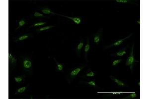 Immunofluorescence of monoclonal antibody to SUMO3 on HeLa cell. (SUMO3 antibody  (AA 1-103))