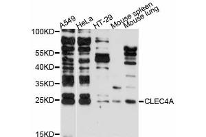 Western blot analysis of extracts of various cell lines, using CLEC4A antibody (ABIN5971451) at 1:3000 dilution. (CLEC4A antibody)