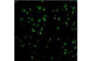 Immunofluorescence of ASK1 in 3T3 cells with AP30086PU-N ASK1 antibody at 20 μg/ml. (ASK1 antibody)