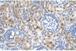 Human kidney; ARMCX6 antibody - N-terminal region in Human kidney cells using Immunohistochemistry (ARMCX6 antibody  (N-Term))
