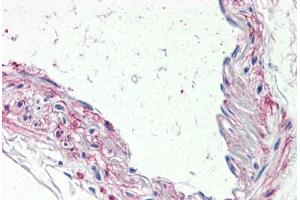 Anti-5HT1B Receptor antibody  ABIN1048254 IHC staining of human vessel. (5HT1B Receptor antibody  (Internal Region))