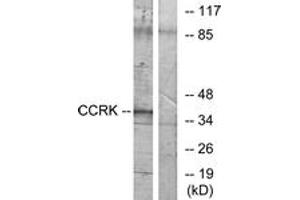 Western Blotting (WB) image for anti-Cyclin-Dependent Kinase 20 (CDK20) (AA 31-80) antibody (ABIN2889669) (CCRK antibody  (AA 31-80))