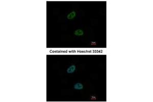 ICC/IF Image Immunofluorescence analysis of paraformaldehyde-fixed HeLa, using C20orf11, antibody at 1:1000 dilution. (GID8/C20orf11 antibody  (Center))