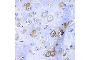 Immunohistochemistry of paraffin-embedded mouse brain using RPS3A Antibody (ABIN5973489) at dilution of 1/100 (40x lens). (RPS3A antibody)