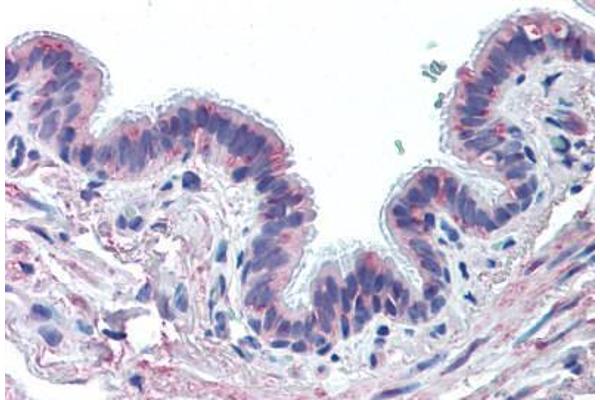 MUC13 antibody  (Extracellular Domain)